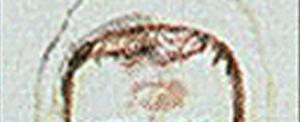 Morph Forehead area